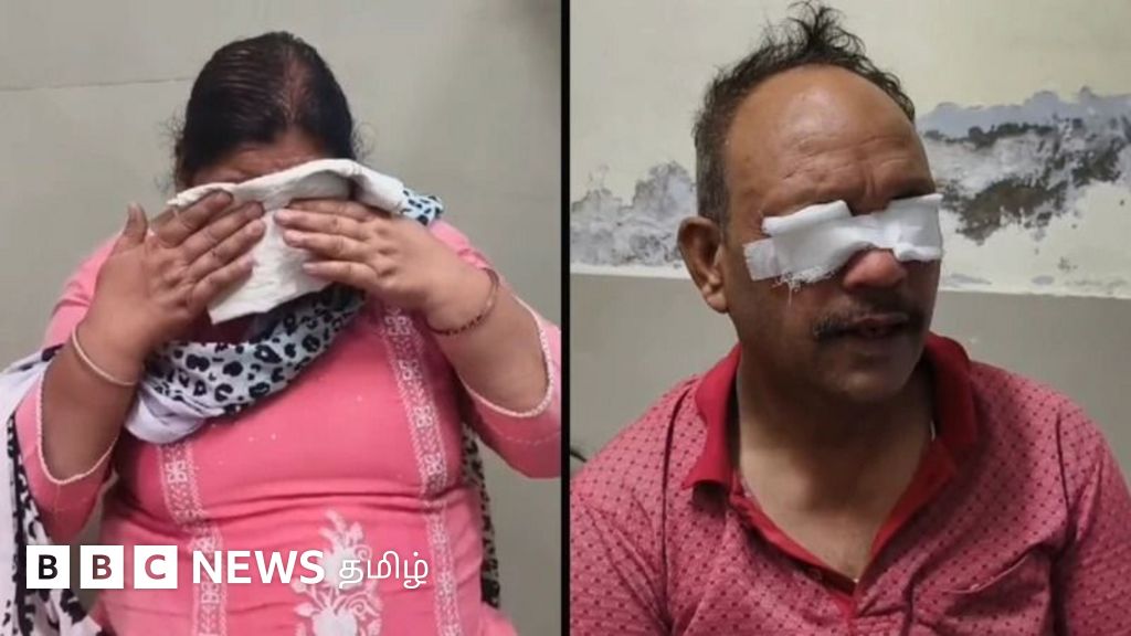 பஞ்சாப் கிராமத்தில் தலை வழுக்கை சிகிச்சைக்கு சென்றவர்கள் கண் நோயால் அவதி - என்ன நடந்தது?