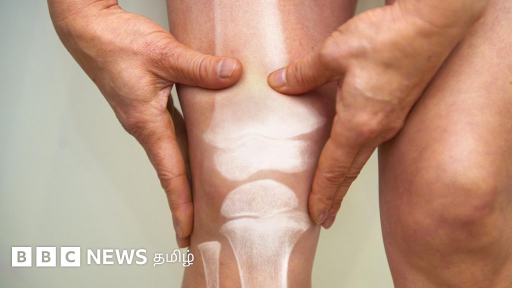 ஆண்களைவிட பெண்களை துரத்தும் எலும்பியல் நோய் பற்றி தெரியுமா?