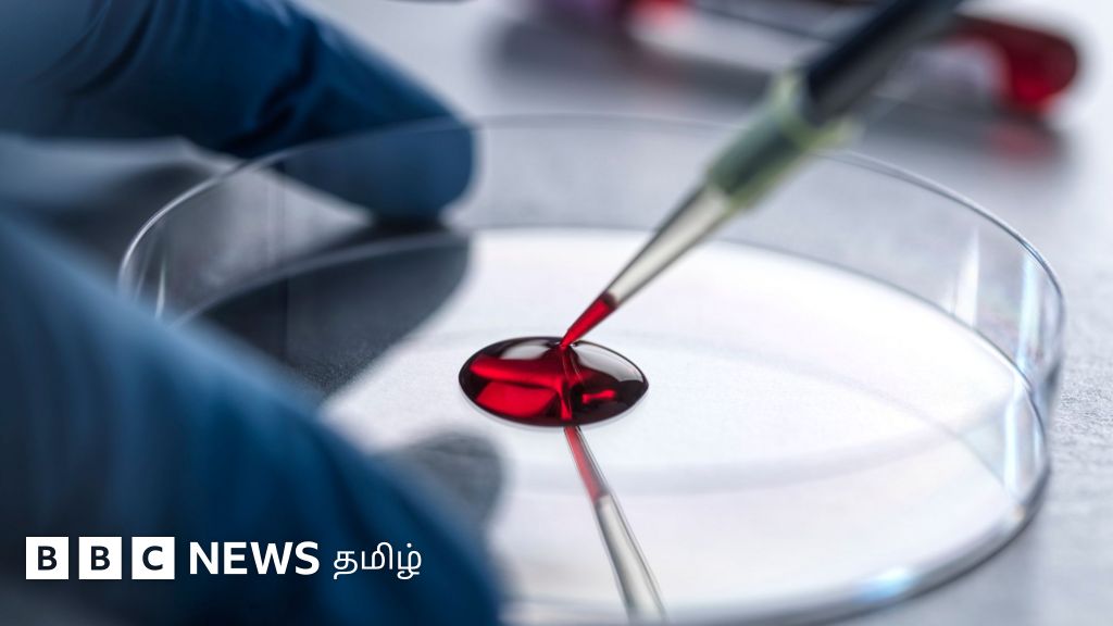 உலகில் ஒரே ஒரு பெண்ணுக்கு மட்டுமே உள்ள அரிய வகை ரத்தம் - வேறு யாரிடமும் ரத்த தானம் பெற முடியாது