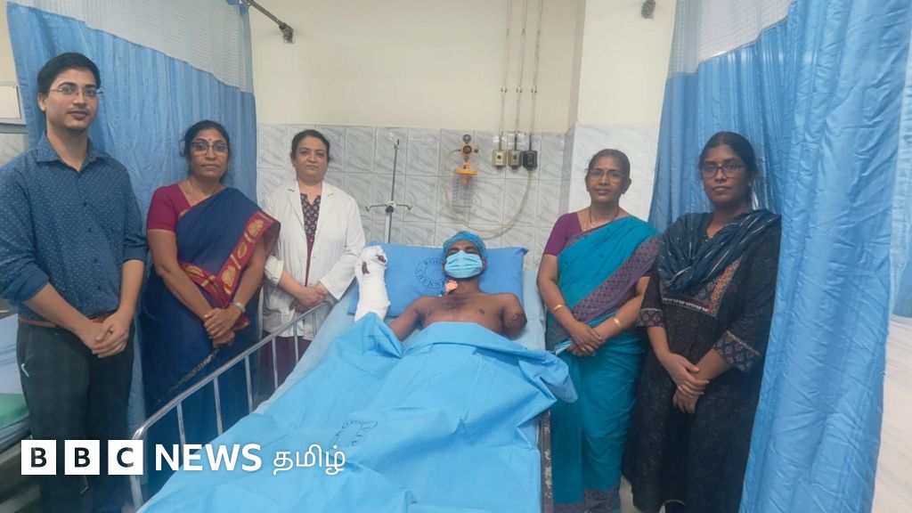 துண்டிக்கப்பட்ட வலது கையில் இடது கையின் ஒரு பகுதி பொருத்தம் - சென்னையில் கூலி தொழிலாளிக்கு என்ன நடந்தது?