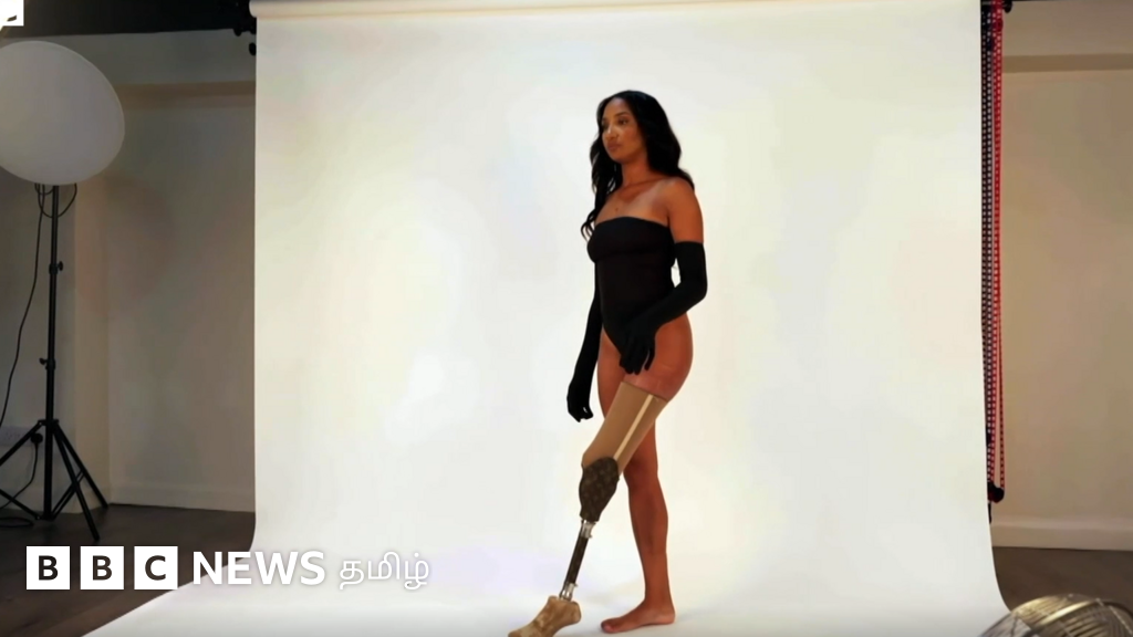 விபத்தில் கால் ஒன்றை இழந்தும் கைகொடுத்த தன்னம்பிகை - தனி ஆளாக சாதித்த பெண்