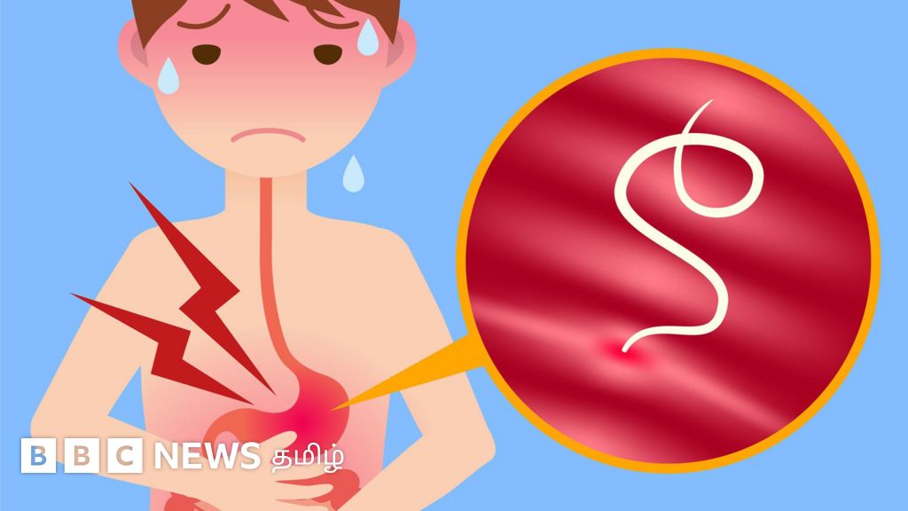 குழந்தைகளின் வயிற்றுக்குள் குடற்புழுக்கள் வருவது எப்படி? அவற்றை எவ்வாறு நீக்க வேண்டும்?