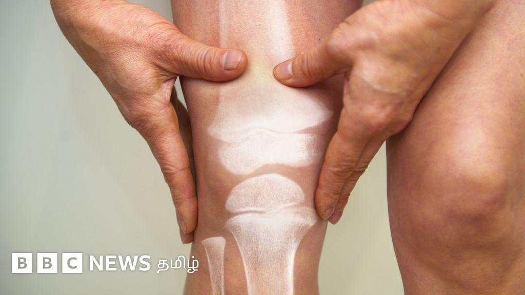 ஆர்த்ரிட்டீஸ் நோய் ஏன் ஏற்படுகிறது? பாதிப்பை குறைப்பது எப்படி?