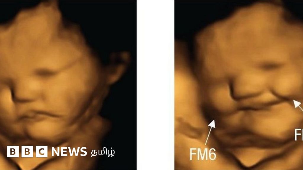 தாயின் கருப்பையில் இருக்கும் சிசு எந்த உணவுக்கு எப்படி எதிர்வினையாற்றும்?
