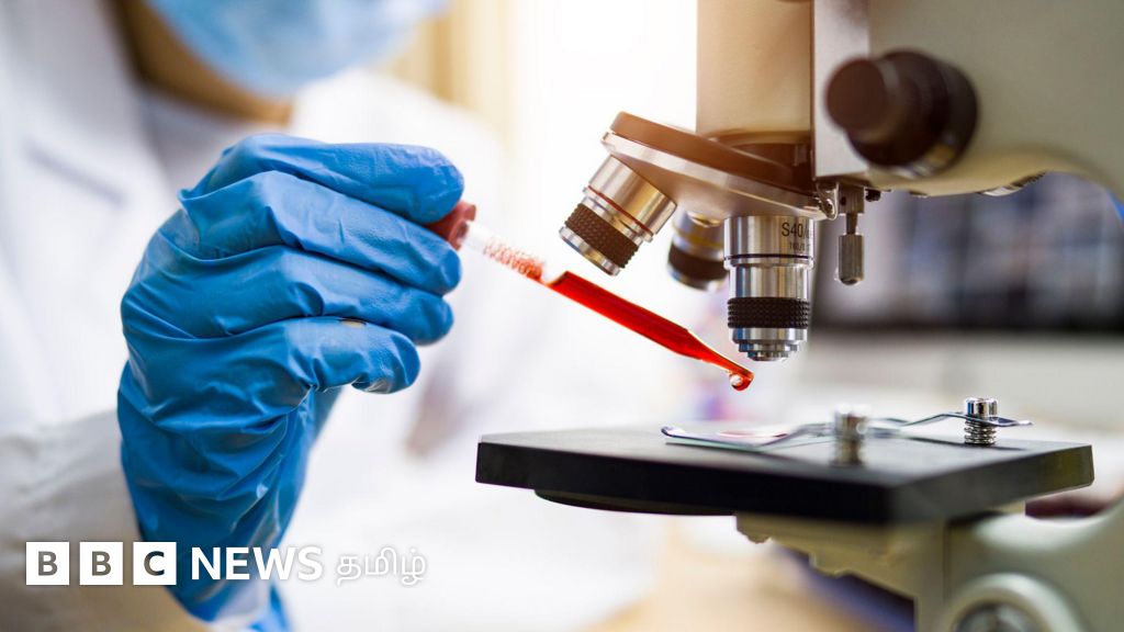 எய்ட்ஸ் நோயை குணப்படுத்த வழி கண்டுபிடித்த விஞ்ஞானிகள் - எச்.ஐ.வி வைரஸை உயிரணுவில் இருந்து நீக்கி சாதனை