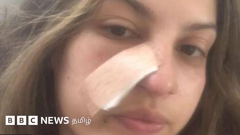 தோல் புற்றுநோய் இருப்பதை கண்டறிய உதவிய 'ஃபேஷியல்' - ஒரே நாளில் தலைகீழாக மாறிய வாழ்கை