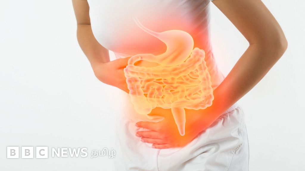 இளைஞர்களிடையே குடல் புற்றுநோய் பாதிப்பு அதிகரிப்பது ஏன்? அறிகுறிகளும் தடுக்கும் வழிகளும்