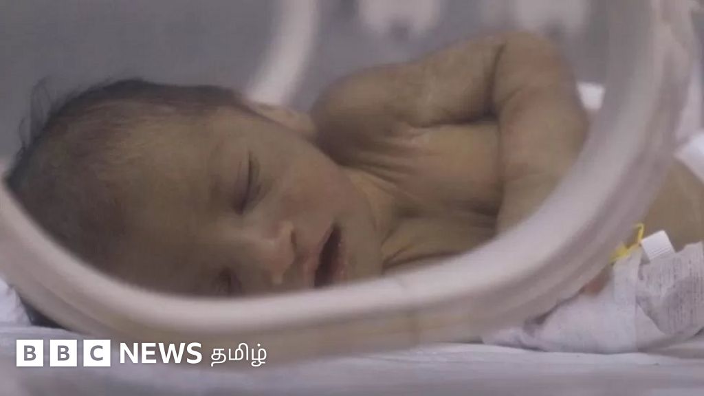 துருக்கி, சிரியா நிலநடுக்கம்: 3 நாட்களில் இரு முறை மீட்கப்பட்ட தாயும் பச்சிளம் குழந்தையும் - துரத்தும் துயரம்