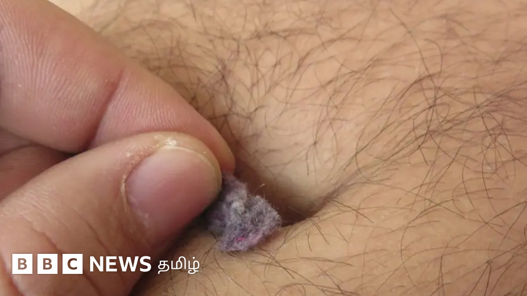 உங்கள் தொப்புளில் பருத்தி போன்று கழிவுகள் சேர்கிறதா? அதனால் என்ன ஆபத்து தெரியுமா?