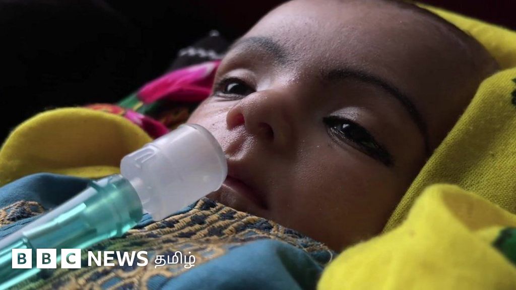 மருந்துகளும் ஆக்சிஜனும் இன்றி இறக்கும் குழந்தைகள்; 'தலைமுறையை இழக்கும்' ஆப்கானிஸ்தான்