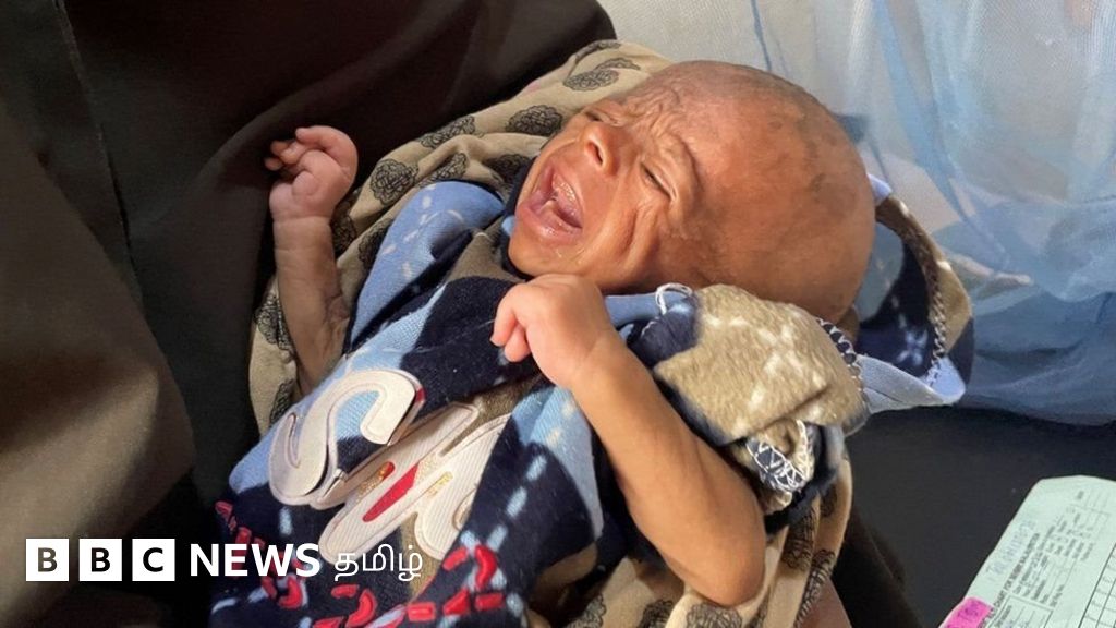 சோமாலியா வறட்சி - 'இறந்த குழந்தையை புதைக்க முடியாத அளவுக்கு பசிக்கொடுமை'