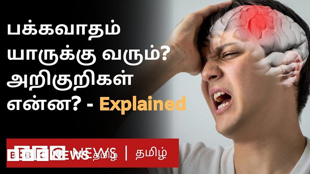 உலக பக்கவாதம் தினம்: கருவில் இருக்கும் குழந்தையை கூட பக்கவாதம் பாதிக்குமா?