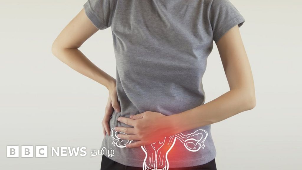 கருப்பைவாய் புற்றுநோய் என்றால் என்ன? அதனை எப்படி கண்டறிவது?