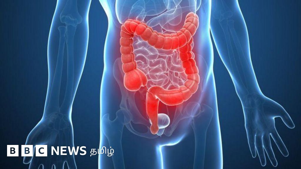 மலத்தில் வெளிப்படும் பெருங்குடல் புற்றுநோயின் முதல் அறிகுறி என்ன?