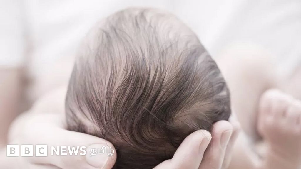 குழந்தையை கடித்துக் கொன்ற நாய்கள்? உசிலம்பட்டி சாலையோரம் காணப்பட்ட கொடுமை