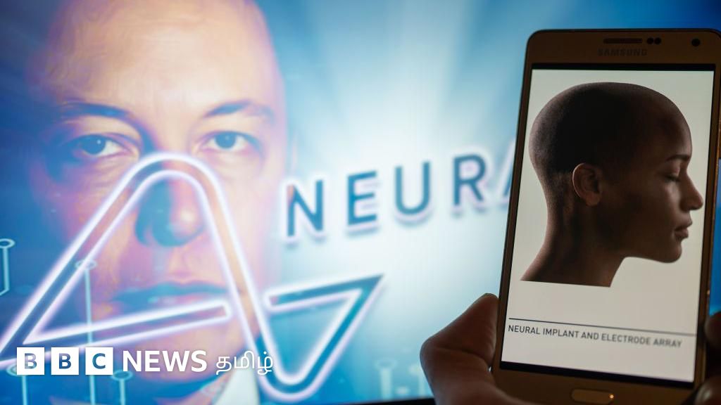 மனித மூளையில் வயர்லெஸ் சிப் பொருத்தி ஈலோன் மஸ்க் நிறுவனம் சாதனை - எவ்வாறு செயல்படும்?