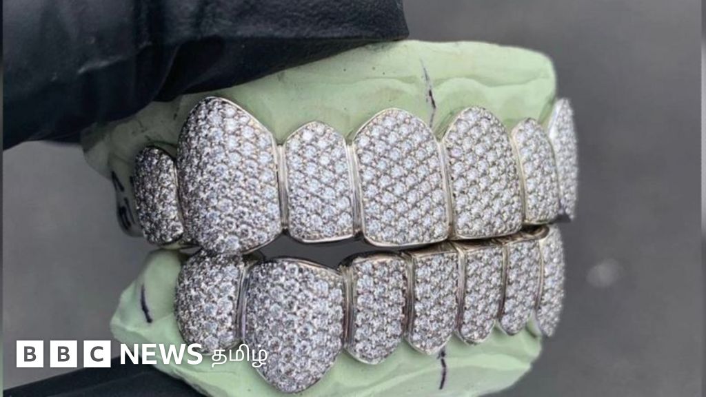 பிரபலமாகி வரும் வைரப் பல் செட்- விலை எவ்வளவு தெரியுமா?