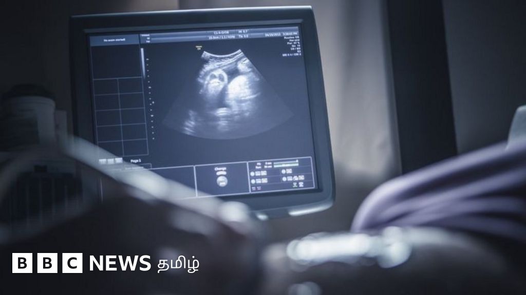 கருப்பையை இடம்மாற்றி கருத்தரிக்க வைக்கும் புதிய நுட்பம் - புற்றுநோய் நோயாளிகளுக்கு வரப்பிரசாதமாக அமையுமா?