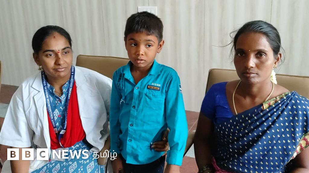 ஏழு வயது சிறுவன் மூக்கில் சிக்கிய 3 பேட்டரிகள் – வேதனைக்கு தீர்வு கண்ட அரசு மருத்துவர்கள்