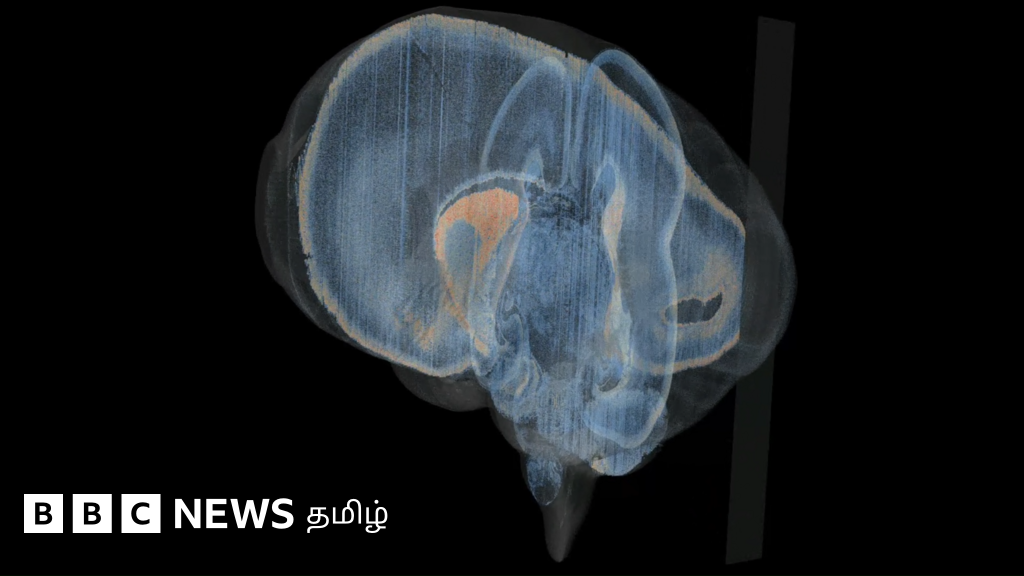 மனிதக் கருவின் மூளை குறித்த ஐஐடி மெட்ராஸின் ஆய்வுகள், மூளை நோய்களைத் தடுக்க உதவுமா?