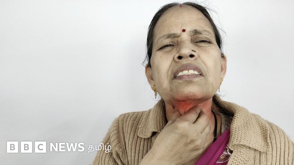 தைராய்டு நோய் என்றால் என்ன? அறிகுறிகள் என்ன? - உலக தைராய்டு தினம்