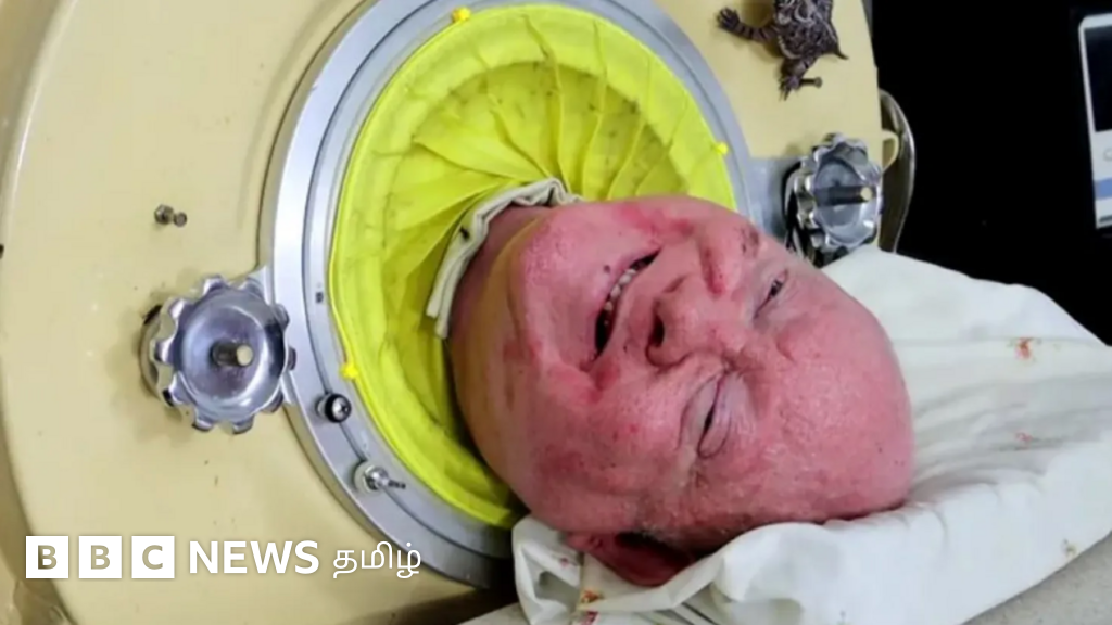 பால் அலெக்சாண்டர்: 78 ஆண்டுகள் இரும்பு நுரையீரலுடன் வாழ்ந்த அதிசய மனிதர் காலமானார்