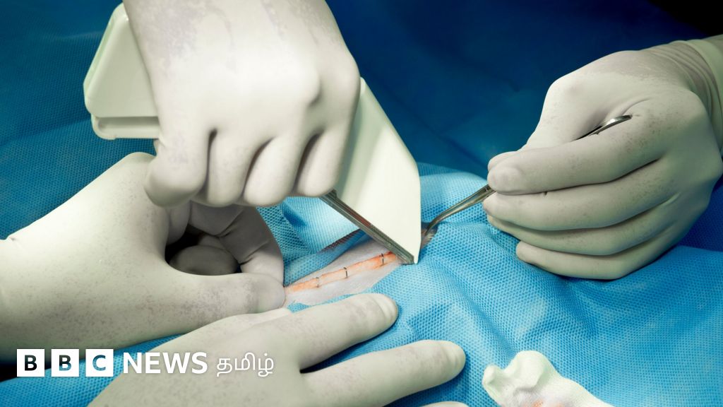 'உடலுக்குள் ஸ்டேபிளர் பின் வைத்துவிட்டனர்' - கோவை நபரின் புகாரும், மருத்துவர்கள் விளக்கமும் என்ன?