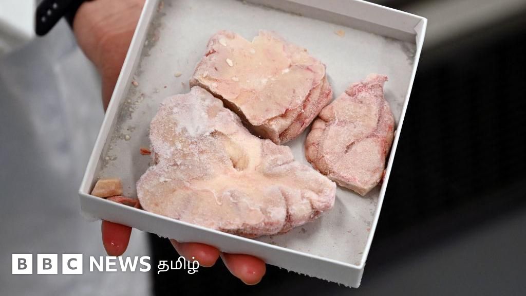 10,000 மனித மூளைகளை பக்கெட்டில் சேமித்து வைத்த பல்கலைக்கழகம் - வியக்க வைக்கும் காரணம்