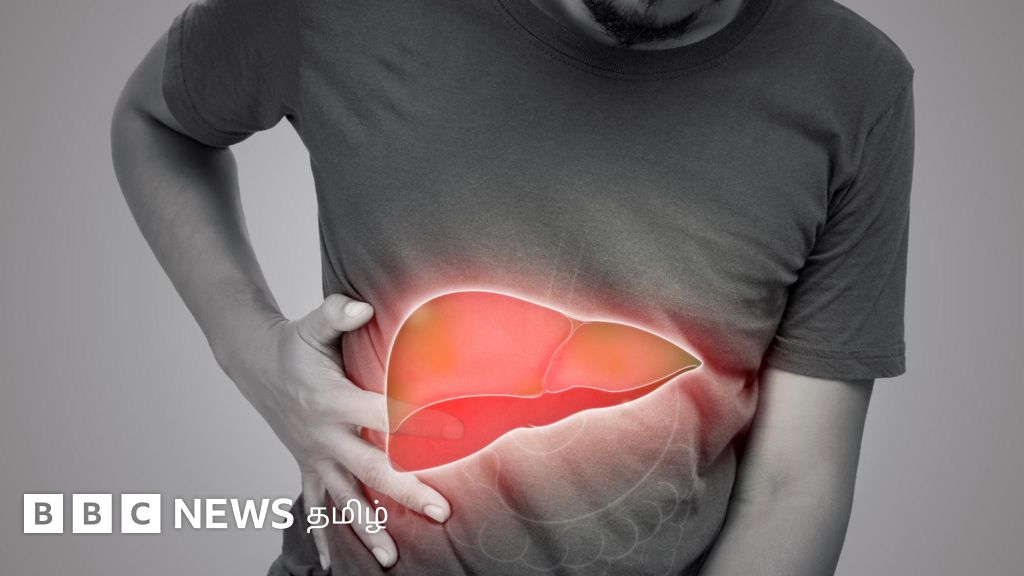 கல்லீரல் அழற்சி எப்படி ஏற்படுகிறது? அறிகுறிகள் என்ன? எப்படி தற்காத்துக்கொள்வது?