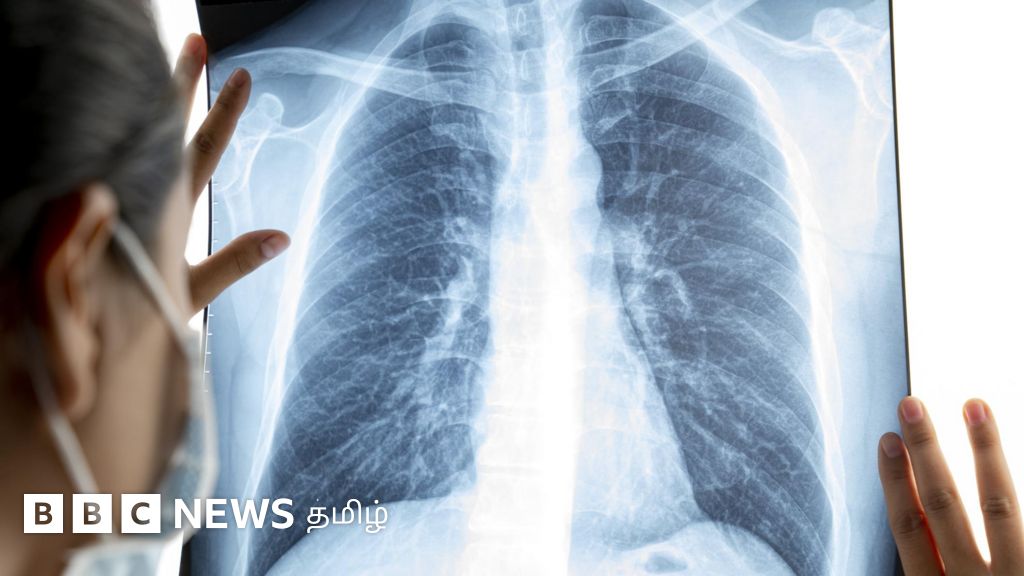 Can A Chest Infection Cause Back Pain