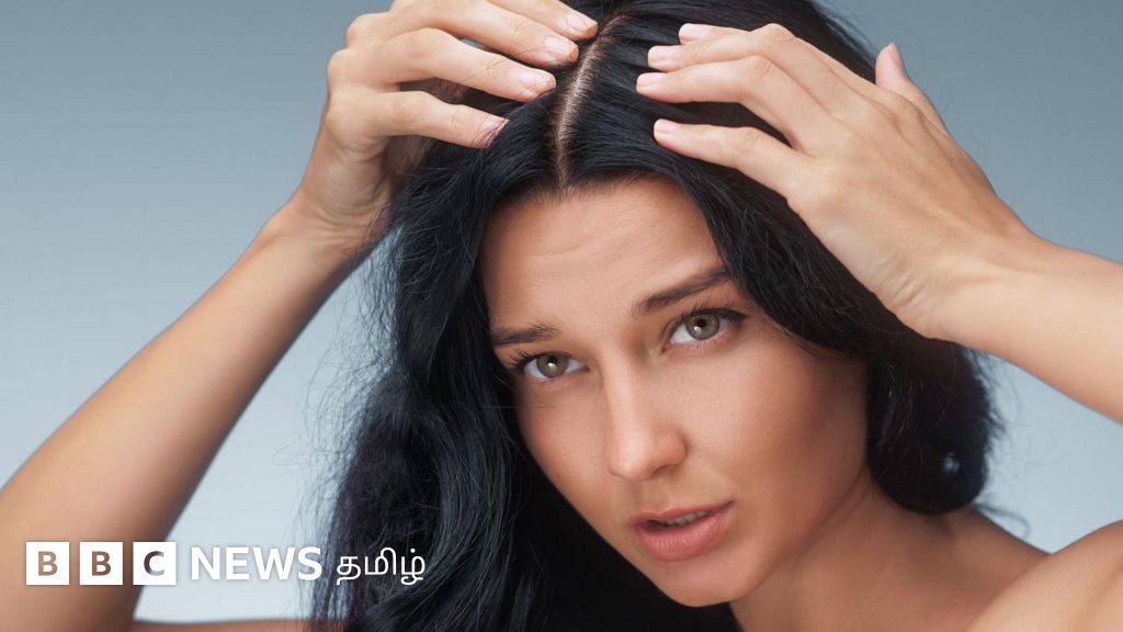 மன அழுத்தம் இருந்தால் வெள்ளை முடி வருமா? - இளநரையை தவிர்ப்பது எப்படி?