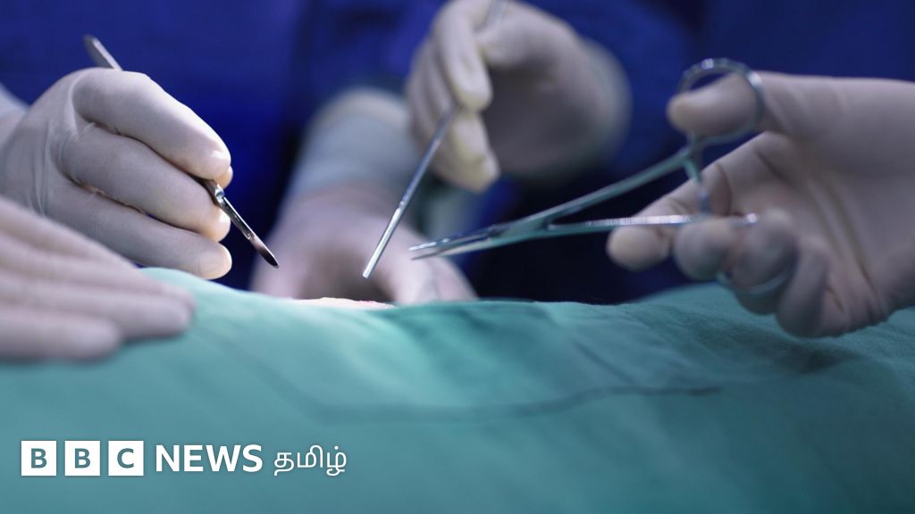 சென்னையில் இளைஞரின் துண்டான கைவிரலுக்கு பதிலாக கால் விரலை பொருத்தியது எப்படி?