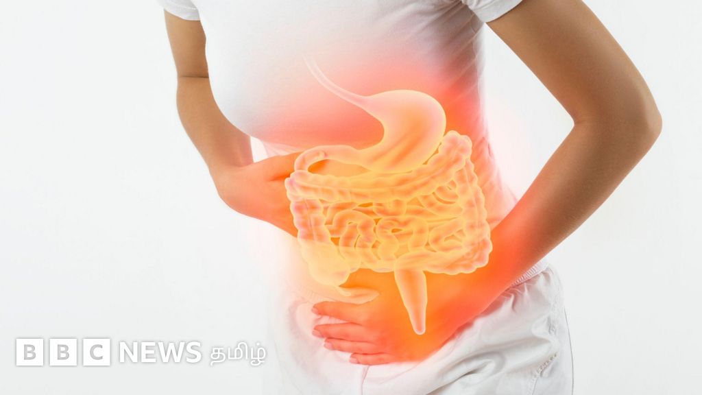 குடல் புற்றுநோய் பாதிப்பு இளைஞர்களிடையே அதிகரிப்பது ஏன்? அறிகுறிகளும் தடுக்கும் வழிகளும்