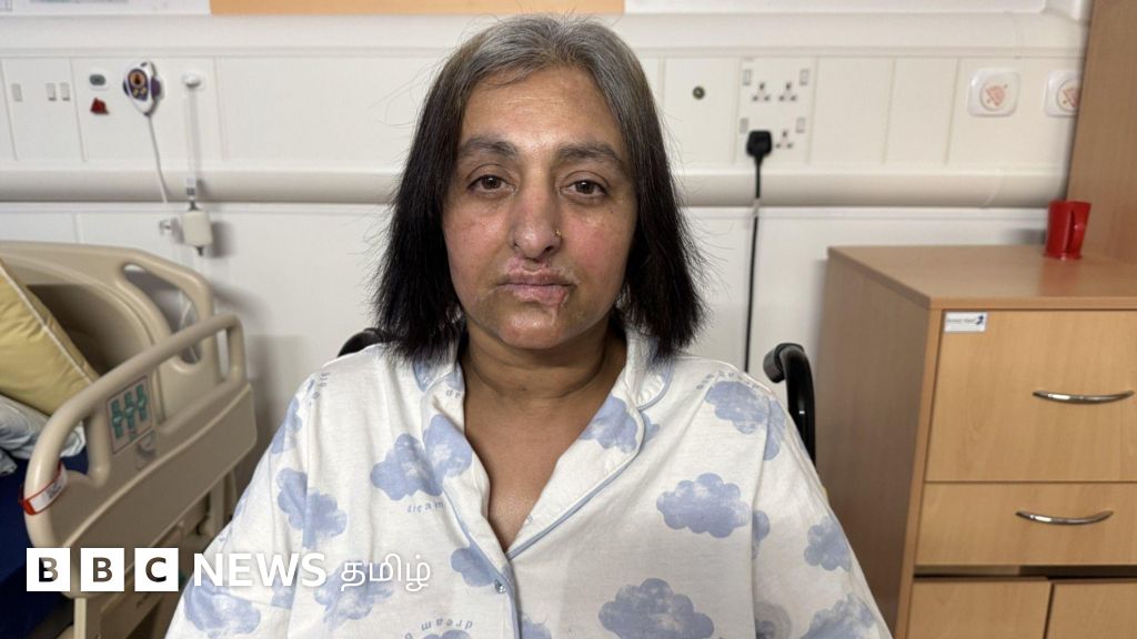 செப்சிஸ்: இந்த பெண் தனது கைகள், கால்களை திடீரென இழக்க என்ன காரணம்?