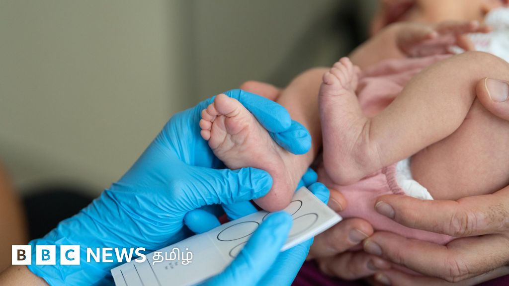 வெறும் 350 கிராம் தான்: தெற்கு ஆசியாவிலேயே குறைந்த எடையுடன் பிறந்த ஆண் குழந்தையை காப்பாற்றிய மருத்துவர்கள் 