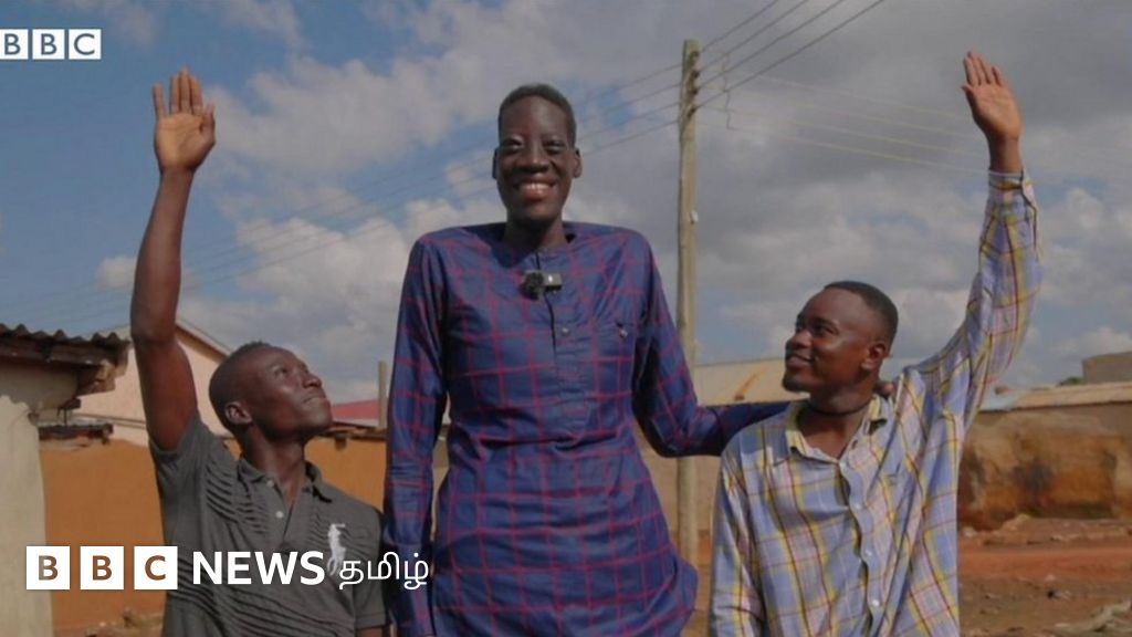 பத்து அடியை நெருங்கி வளர்ந்துகொண்டிருக்கும் மனிதர் - அறுவை சிகிச்சைக்கு பரிந்துரை