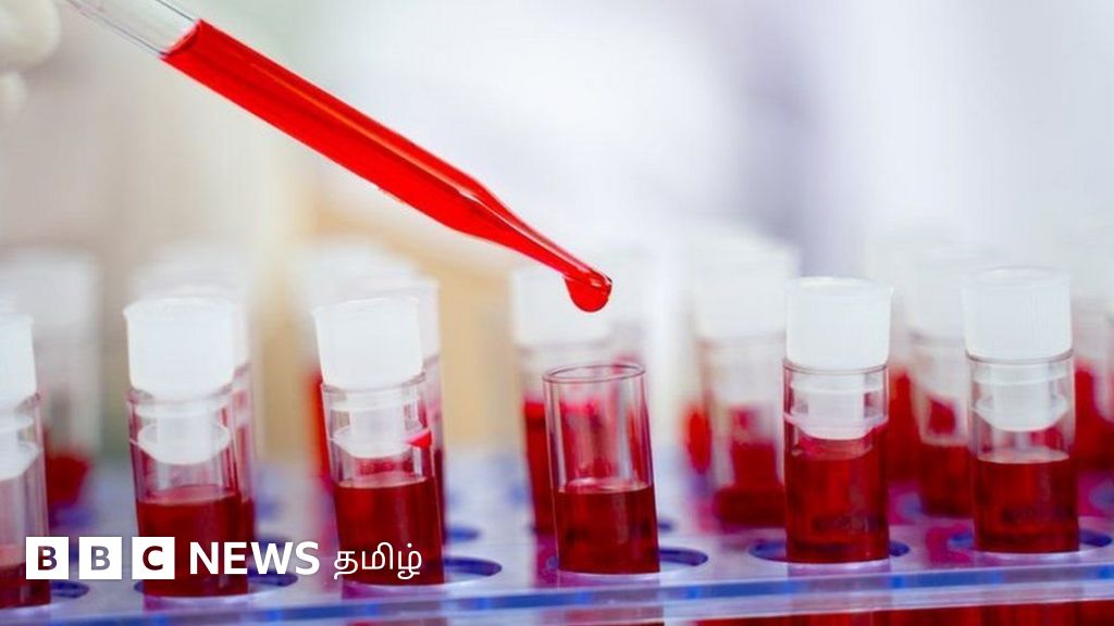 அறிவியல் அதிசயம்: ஹெச்ஐவி பாதிப்பில் இருந்து சுயமாக விடுவித்துக் கொள்ளும் பெண் உடல்