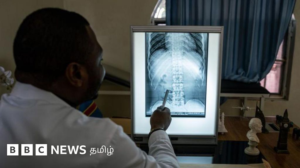 பள்ளி மாணவர், இளைஞர்களுக்கு முதுகுவலி வருவது ஏன்? மருத்துவரை எப்போது அணுக வேண்டும்?