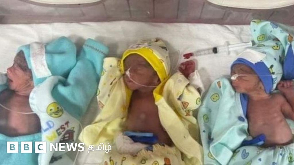 பாகிஸ்தானில் ஒரே பிரசவத்தில் 7 குழந்தைகளைப் பெற்ற தாய், 6 குழந்தைகளை இழந்த சோகம்