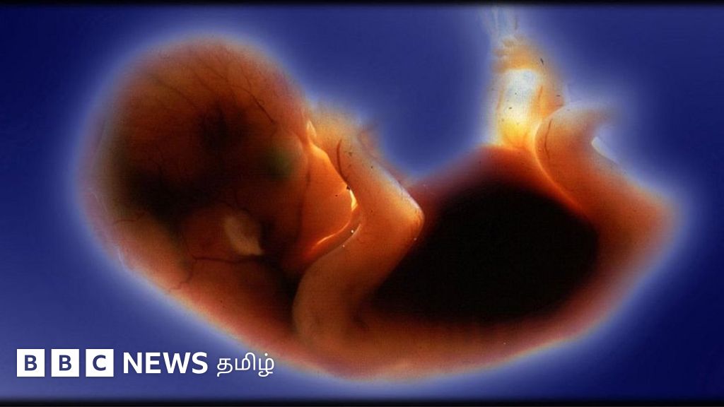 கருவில் இருப்பது பூவா, தலையா: சங்கேதமாக பாலினம் சொல்லும் ஸ்கேன் மையங்கள்