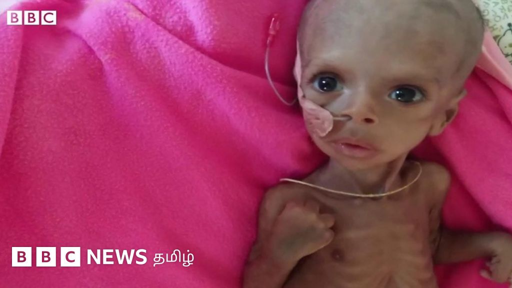 எத்தியோப்பியா உள்நாட்டு போர்: குழந்தைக்கு தாய்ப்பால் கொடுக்கக் கூட வழி இல்லை - தவிக்கும் டீக்ரே மக்கள்