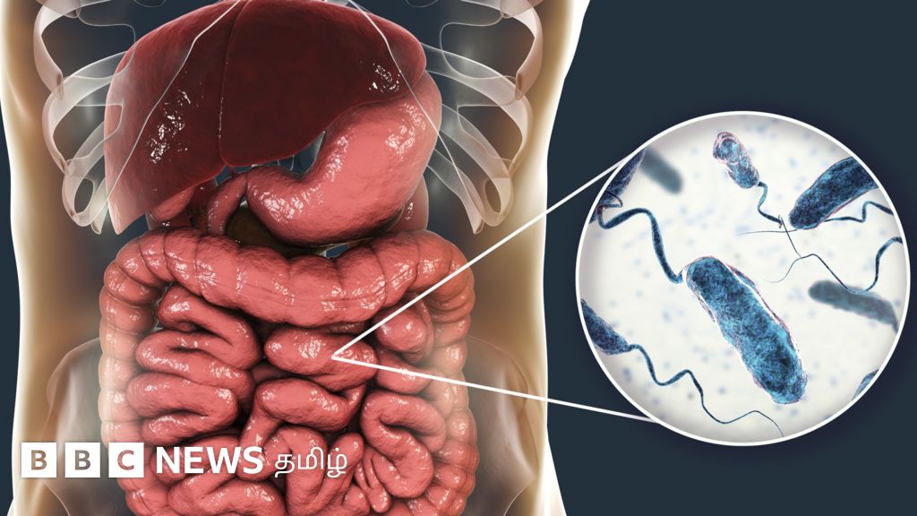 காலரா தொற்றை தடுக்க இதை செய்யுங்கள் - மருத்துவர் விளக்கம்