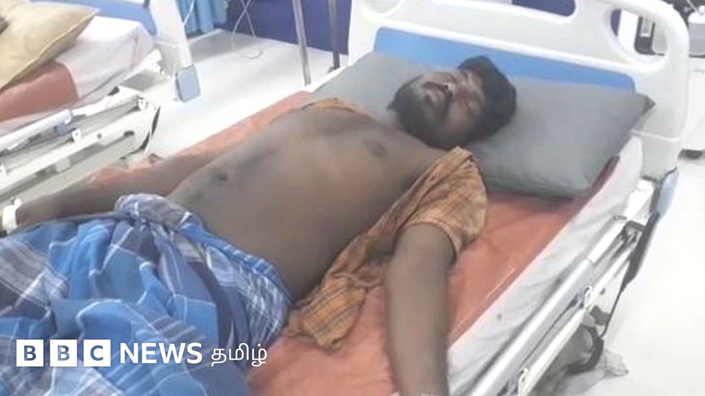 கள்ளக்குறிச்சியில் கைதான குறவர்களில் ஒருவருக்கு நெஞ்சுவலி என மருத்துவமனையில் அனுமதி