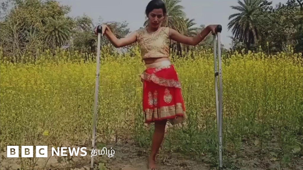 “கால் போனாலும் கலையை விடாத கலைஞர்” – வைரலாகும் யூட்யூபர்