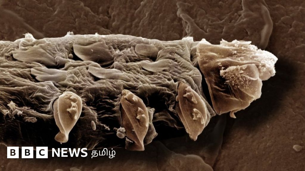 உடல் நலம்: டெமோடெக்ஸ் ஃபோலிகுளோரம் - நம் முகத்திலேயே உடலுறவு கொள்ளும் இந்த உயிரினத்துக்கு இப்போது சிக்கல்