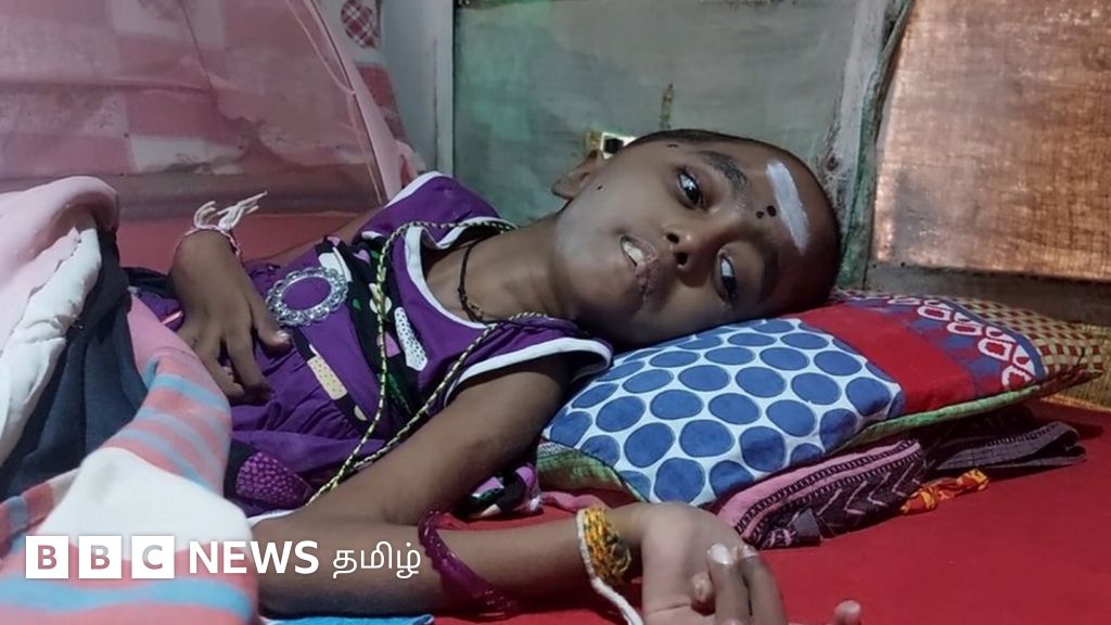 மலையக குழந்தைகளுக்கு ஊட்டச்சத்து குறைபாடு - பிபிசி தமிழின் கள ஆய்வு