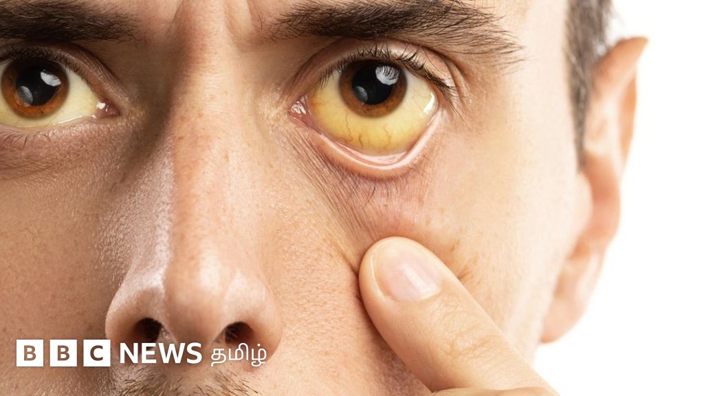 உங்கள் கண்கள் உங்களுடைய உடல் ஆரோக்கியத்தை சொல்லும் - ஓர் அலசல்