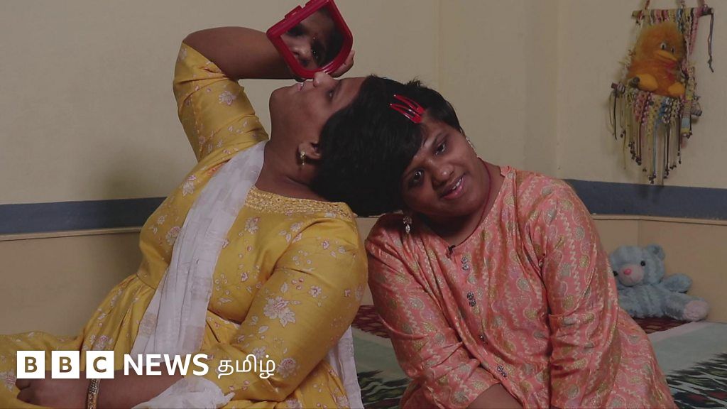 ஹைதராபாத் நகர ஒட்டிப்பிறந்த இரட்டையர்கள் பிளஸ் டூ பாஸ் செய்த நம்பிக்கை கதை: பெற்றோர் கைவிட்ட பிறகு சாதித்தனர்