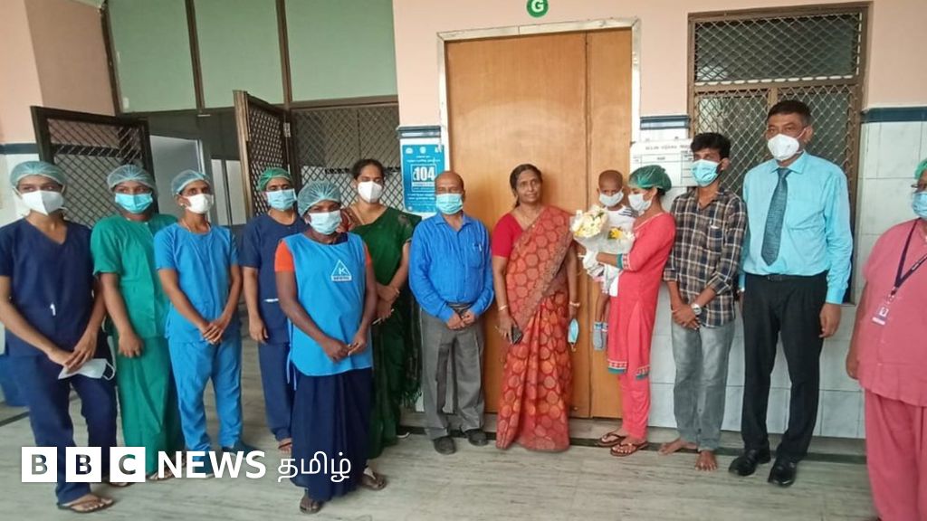 அரியவகை புற்றுநோயால் பாதிக்கப்பட்ட 4 வயது குழந்தை - அரசு மருத்துவர்களின் முயற்சியால் மீண்ட தருணம்