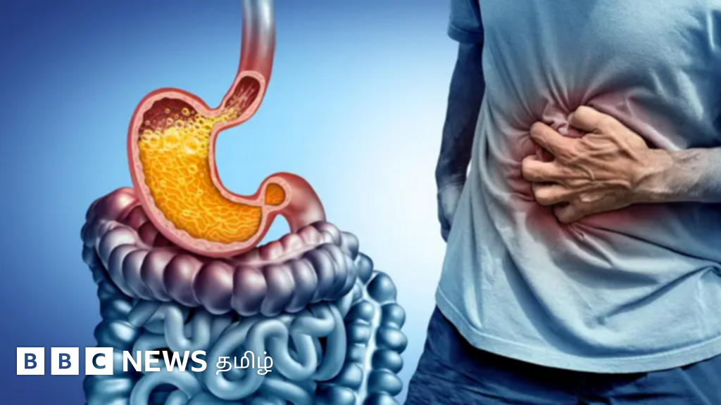 சாப்பிட்ட உடனேயே தூங்குவதால் அசிடிட்டி அதிகரிக்குமா? 